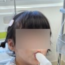 용인제일메디병원 공휴일진료 입원가능한 처인구 소아과 폐렴 입원 후기