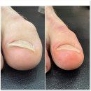 뷰티 라이프 샵 | 시흥 능곡역 내성발톱 전문 브랜드샵 방문 후기 뷰티업라이프 뷰티제작소 시흥장현점