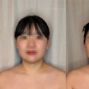 정테라피 | 왕십리 피부관리 환골 윤곽 테라피 90분 후기 정율환골윤곽연구소