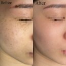 인동8길-1 이미지