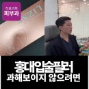 영진의원 | 홍대 입술필러, 과해 보이지 않기 위해 이 2가지를 확인하세요