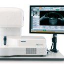 닥터아이씨엘안과의원 | 닥터아이씨엘안과 렌즈삽입술 후기 7일차