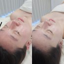 GS25 경산옥산점 | 경산피부관리 잘하는 곳, 물오른피부 경산점에서 맞춤 관리 후기