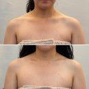백의민족피부