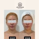 석촌고분역4번출구 이미지