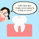 수성뉴플란트치과의원 네이버블로그