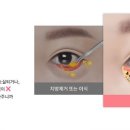 강남안성형외과의원 이미지