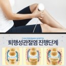 골관절염치료기