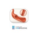 누웠을때 등통증으로 눕기 불편하시다면