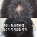 임수희 두피헤어센스 | 용인두피문신 잘하는곳 닷센스 SMP 용인광교점 가르마 문신후기