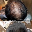 블레싱헤어 이미지