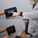 앞볼 옆볼패임 볼꺼짐엔 레디어스 콜라겐주사가 직방