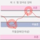 어랍쇼ㅋ 우울증인 나, 어쩌면 조울증일 수도? 이미지