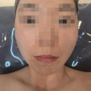 뷰티관리 맛집 에스테티아 병점점 윤곽관리코스 후기