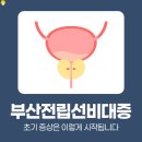 수피부비뇨기과의원 | 서면비뇨기과 전립선 건강 증상별 진단과 관리 방법