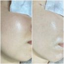 부산서면 | 서면 에스테틱 서면 피부관리 온어시즌 에스테틱 부산서면점 후기
