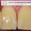 뉴티스치과교정과치과의원 이미지