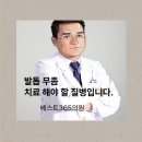 청주 발톱무좀 치료 병원에서 알려드립니다.