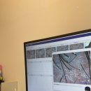 탑환경 | 논현 두피관리, 탑스칼프 논현점에서 복합성두피관리,두피디톡스 받은 후기