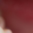 서울라미플란트치과교정과치과의원 이미지