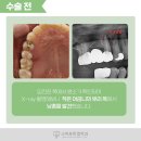 스마트한결치과 이미지