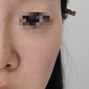 남양주 신상 토탈 뷰시엘스튜디오 신부 기초케어 및 피부결정리