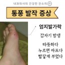 통풍 및 정보통증 이미지