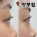 부림 | [청주 속눈썹펌] 가경동 멋부림 속눈썹펌 후기
