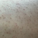 피질 강직도 =피질 하경색 피부 갈색얼룩 주파수직종 짧으신 개꼬들이 의식탑재 입증완료? 강제 데이터화 이미지