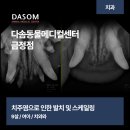 남천동 이광재 정형외과 앞 | 부산 남천동 동물병원 치주염으로 인한 발치를 진행한 9살 강아지의 사례