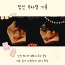 주차37 | 임신 후기 36 37 38 주차 특징 증상 태동 검사 제왕절개 날짜 확정