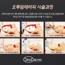 용테라피