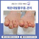 미리케어스