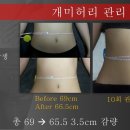 미랑에스테틱 네이버블로그
