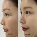 더뉴본 | ems얼굴마사지기 추천 밀레스 더뉴 고주파마사지기 솔직 후기