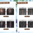 리바이브헤어 이미지