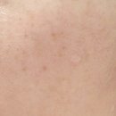 리페로 | 크림추천 이엔코스 리페어덤 시카프로 병풀크림