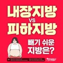 내장지방 vs 피하지방 이미지