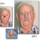 Medical Prosthetics 이미지