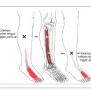 Extensor Digitorum Longus (장지신근) 이미지