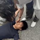 코마