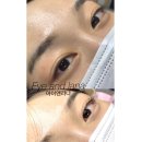 아이앤라나