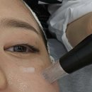 천사크리닝 | 차오르는 피부재생관리 김해탑티어 아라모먼트 후기(Radiant Moment피부관리, 연지공원 피부재생샵 추천)