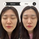 페이스디자인 | 전주 에코시티 스킨플라청담 - 1:1 피부관리, 개인맞춤 전문 페이스디자인 페이스핏톡스케어 후기