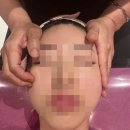 스파얀 | 대구거북목관리 팔자주름 개선되는 대구윤곽관리 후기