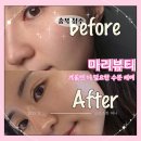 허리우드 | 겨울철 피부관리 마리뷰티 비타민백옥테라피로 청주수분관리로 촉촉한 케어하기