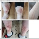 피부사랑 이미지