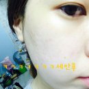 파에온메드 이미지