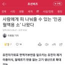 사람에게 피 나눠줄 수 있는 ‘인공혈액용 소’ 나왔다 이미지