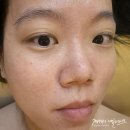 비움과 채움 | 행신 피부샵 비움과채움 트러블 진정 물방울 관리 후기